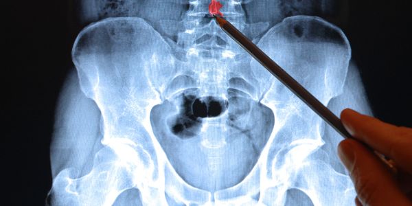 Image related to No X-ray service in Abingdon after 5pm on June 30th